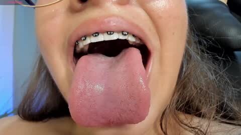 Media: Video of a woman with light skin, glasses, and braces, open mouth, tongue extended, showing teeth. Background blurred.